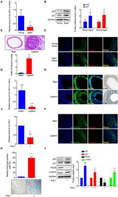 circ-Sirt1 Decelerates Senescence by Inhibiting p53 Activation in Vascular Smooth Muscle Cells, Ameliorating Neointima Formation